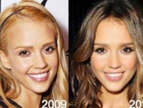 Jessica Alba before and after plastic surgery 32