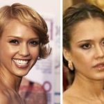 Jessica Alba before and after plastic surgery 39