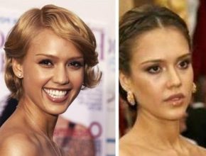 Jessica Alba before and after plastic surgery 39
