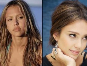 Jessica Alba before and after plastic surgery 45