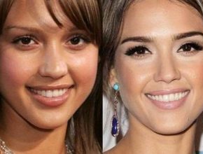 Jessica Alba before and after plastic surgery 51