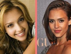 Jessica Alba before and after plastic surgery 55