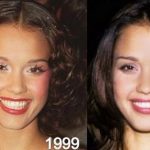 Jessica Alba before and after plastic surgery 57