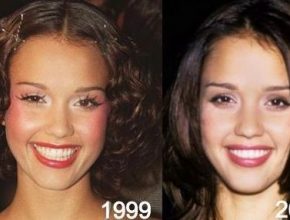 Jessica Alba before and after plastic surgery 57