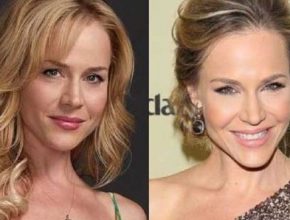 Julie Benz before and after plastic surgery 4