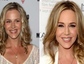 Julie Benz before and after plastic surgery
