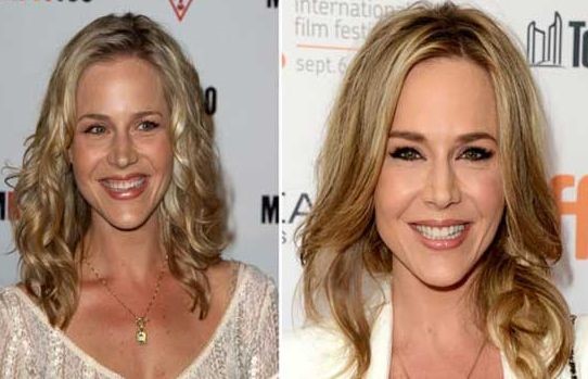 Julie Benz before and after plastic surgery 