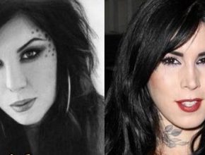 Kat Von D before and after plastic surgery