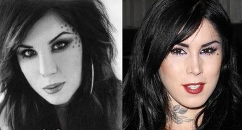 Kat Von D before and after plastic surgery
