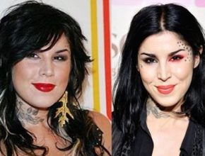 Kat Von D before and after plastic surgery 30