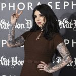 Kat Von D plastic surgery 25