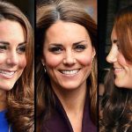 Kate Middleton before and after plastic surgery 2