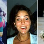 Kate Middleton before and after plastic surgery 29