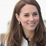 Kate Middleton plastic surgery 1