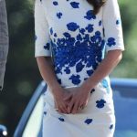 Kate Middleton plastic surgery 12