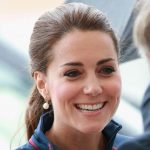 Kate Middleton plastic surgery 18