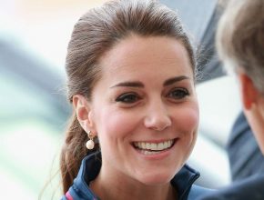Kate Middleton plastic surgery 18