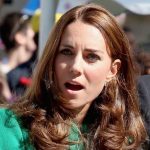 Kate Middleton plastic surgery 19