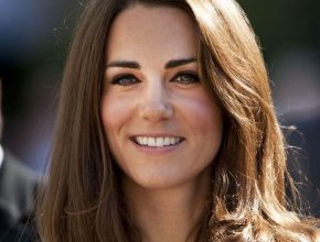 Kate Middleton plastic surgery 24