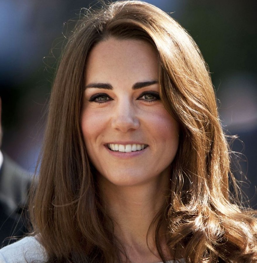 Kate Middleton plastic surgery 24 – Celebrity plastic surgery online
