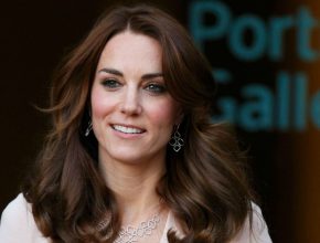 Kate Middleton plastic surgery 25