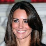 Kate Middleton plastic surgery 26
