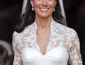 Kate Middleton plastic surgery