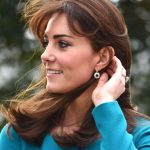 Kate Middleton plastic surgery 28