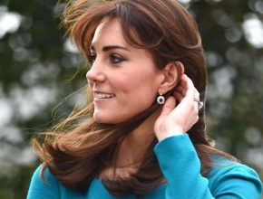 Kate Middleton plastic surgery 28