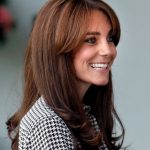Kate Middleton plastic surgery 3