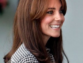 Kate Middleton plastic surgery 3