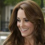 Kate Middleton plastic surgery 31