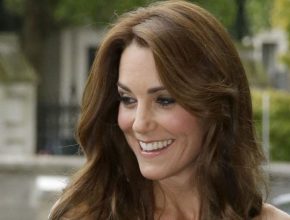 Kate Middleton plastic surgery 31