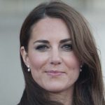 Kate Middleton plastic surgery 36