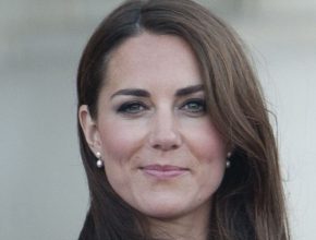 Kate Middleton plastic surgery 36