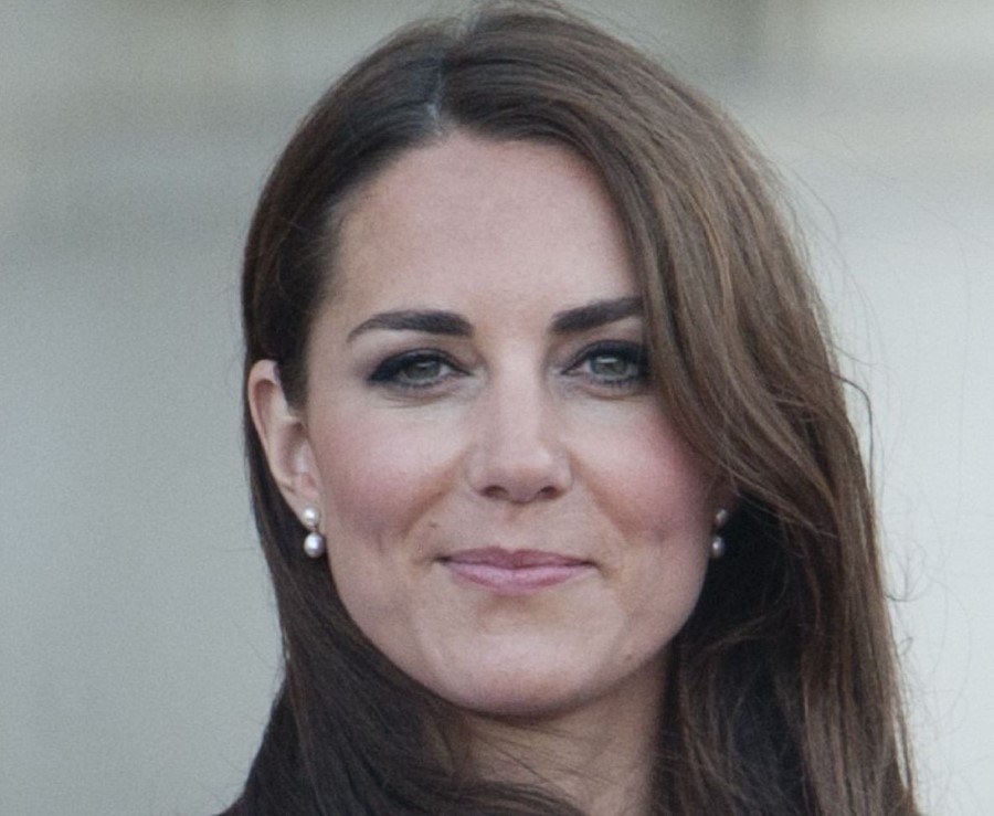 Kate Middleton plastic surgery 36 Celebrity plastic surgery online