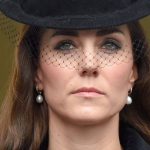 Kate Middleton plastic surgery 37