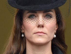 Kate Middleton plastic surgery 37