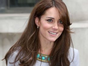 Kate Middleton plastic surgery 48