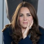 Kate Middleton plastic surgery 49