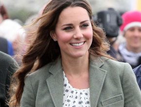 Kate Middleton plastic surgery 5