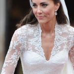 Kate Middleton plastic surgery 50