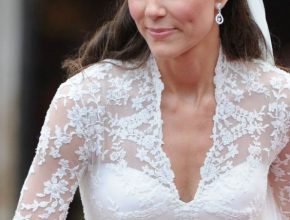 Kate Middleton plastic surgery 50
