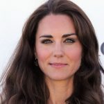 Kate Middleton plastic surgery 51