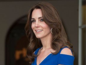 Kate Middleton plastic surgery 55
