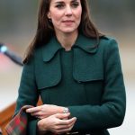 Kate Middleton plastic surgery 58