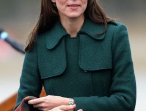 Kate Middleton plastic surgery 58