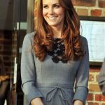 Kate Middleton plastic surgery 6