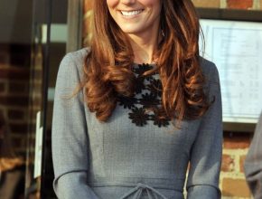 Kate Middleton plastic surgery 6