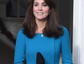 Kate Middleton plastic surgery 7